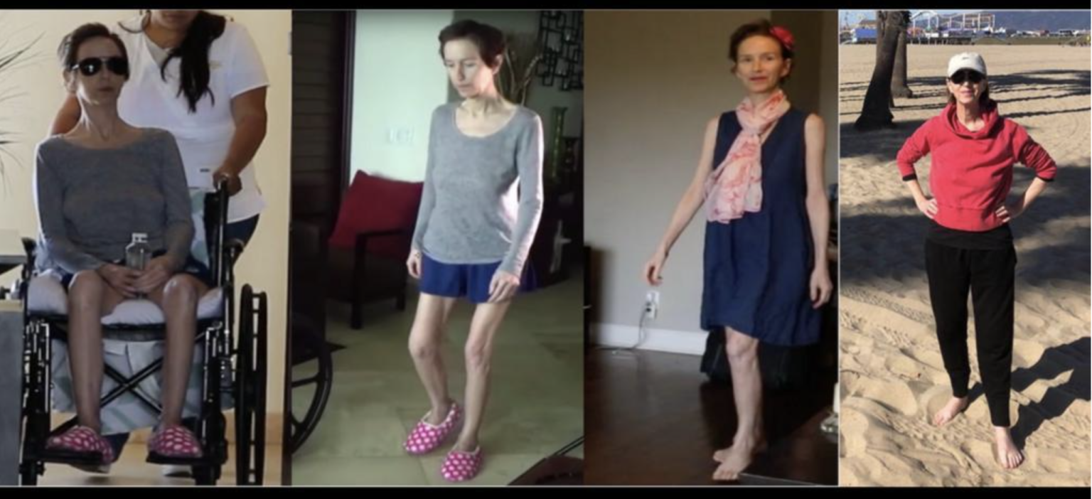 Luxury Stem Cell Treatment Mexico Sanctuary Tulum